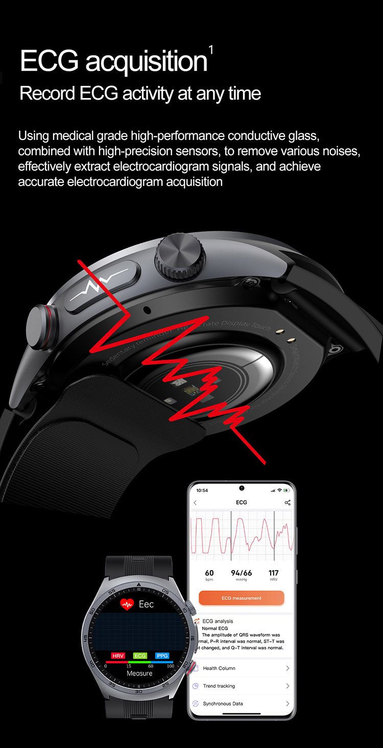 ECG Smartwatch